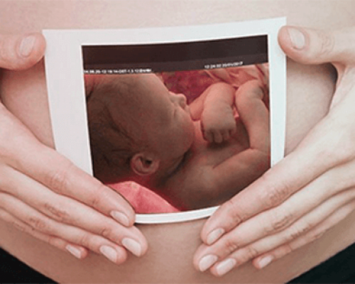Экспертное 4D-УЗИ беременных фото